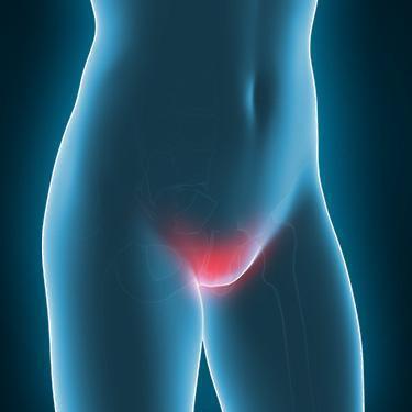 Bartholin S Cyst Symptoms Diagnosis Treatment From Your Md